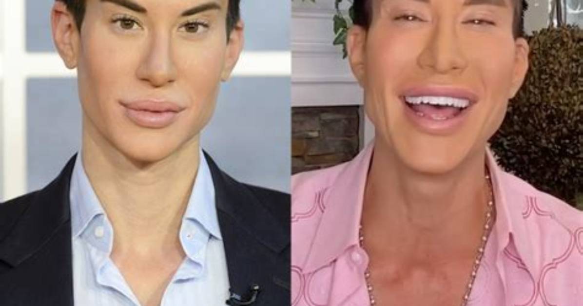 A Botched-up Surprise: Uncovering Justin's Plastic Surgery Disasters
