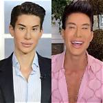 A Botched-up Surprise: Uncovering Justin's Plastic Surgery Disasters