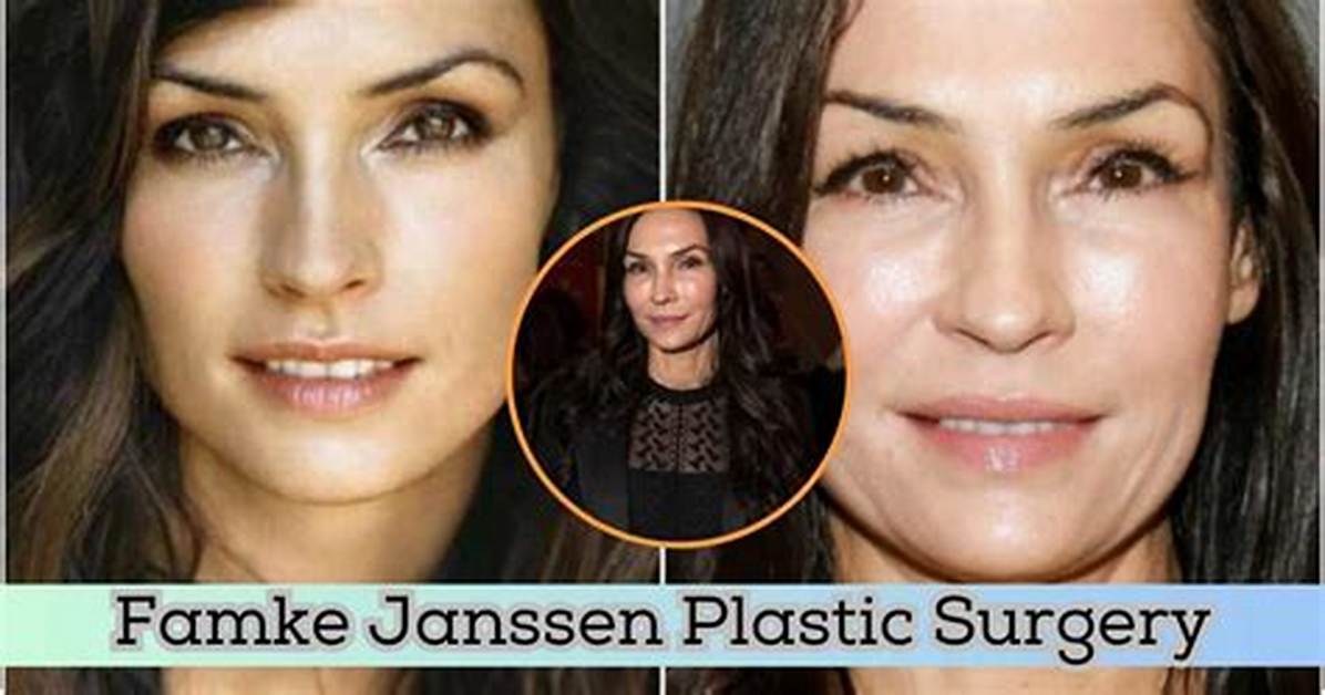 A Deeper Look: Famke Janssen's Plastic Surgery Journey