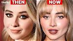 Analyzing Sabrina Carpenter's Transformation: Rumored Plastic Surgery