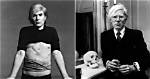 Andy Warhol Cause of Death