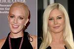 Astonishing Transformation: Heidi Pratt's Journey Before and After