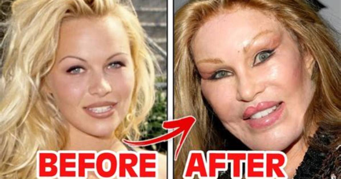 Before and After Plastic Surgery Photo ·