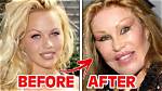 Before and After Plastic Surgery Photo ·