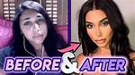Chantel Jeffries Plastic Surgery Before and After ·