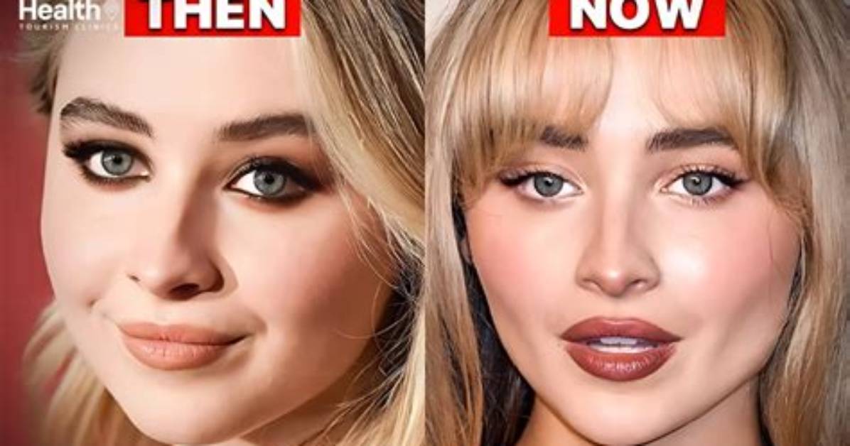 Did Sabrina Carpenter Have Work Done? an in-Depth Analysis