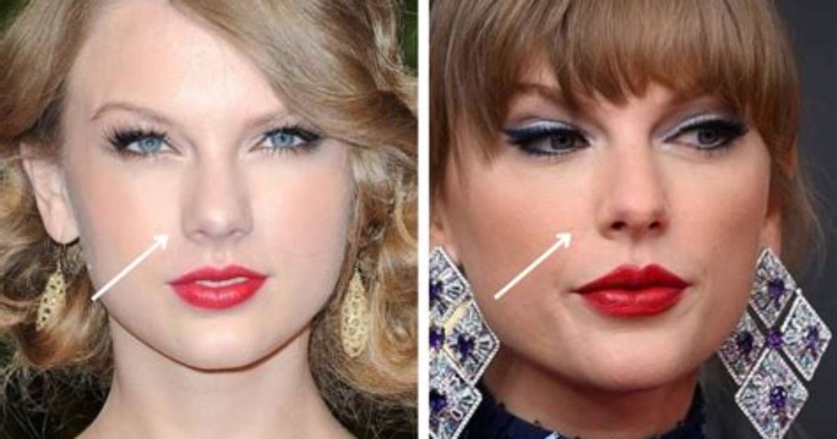 Did She Get Nose Job? ·