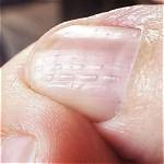 Discover the Meaning Behind Horizontal Nail Ridges: a Guide to Nail Health