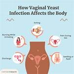 Do Bidets Really Cause Yeast Infections? the Truth Revealed