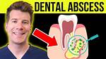 Don't Ignore Gum Abscess! Get Relief Now