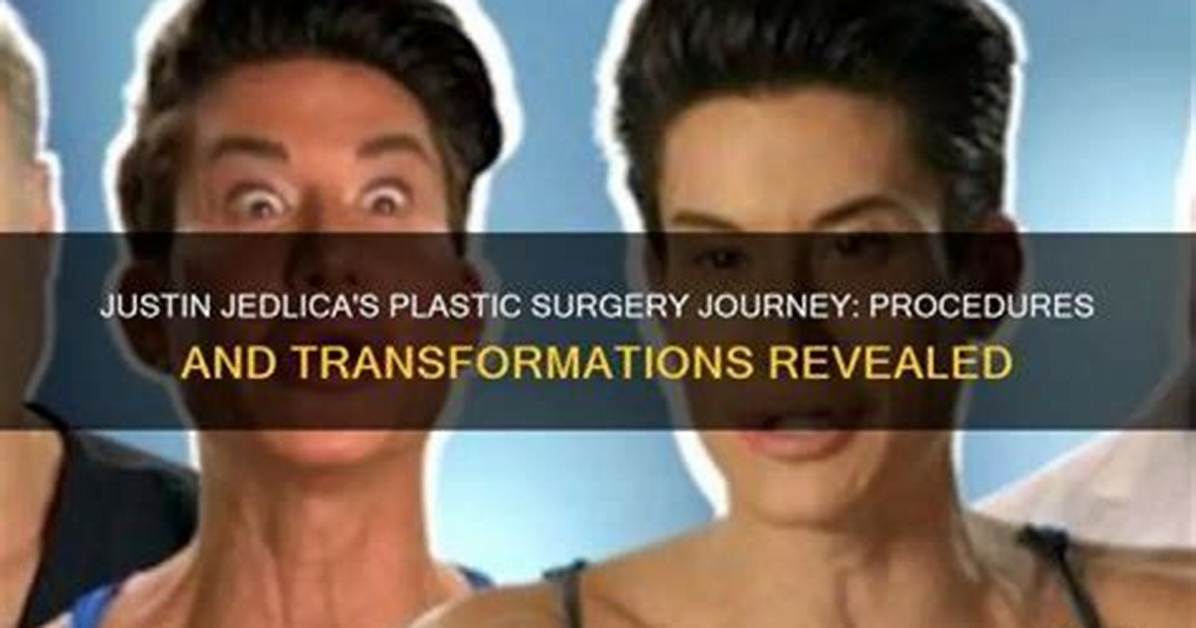 Epic Plastic Surgery Transformation of Justin Jedlica