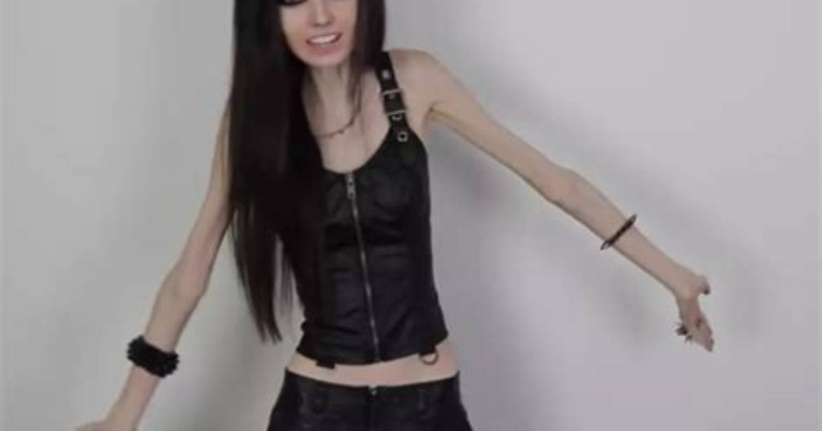 Eugenia Cooney's Journey to Recovery