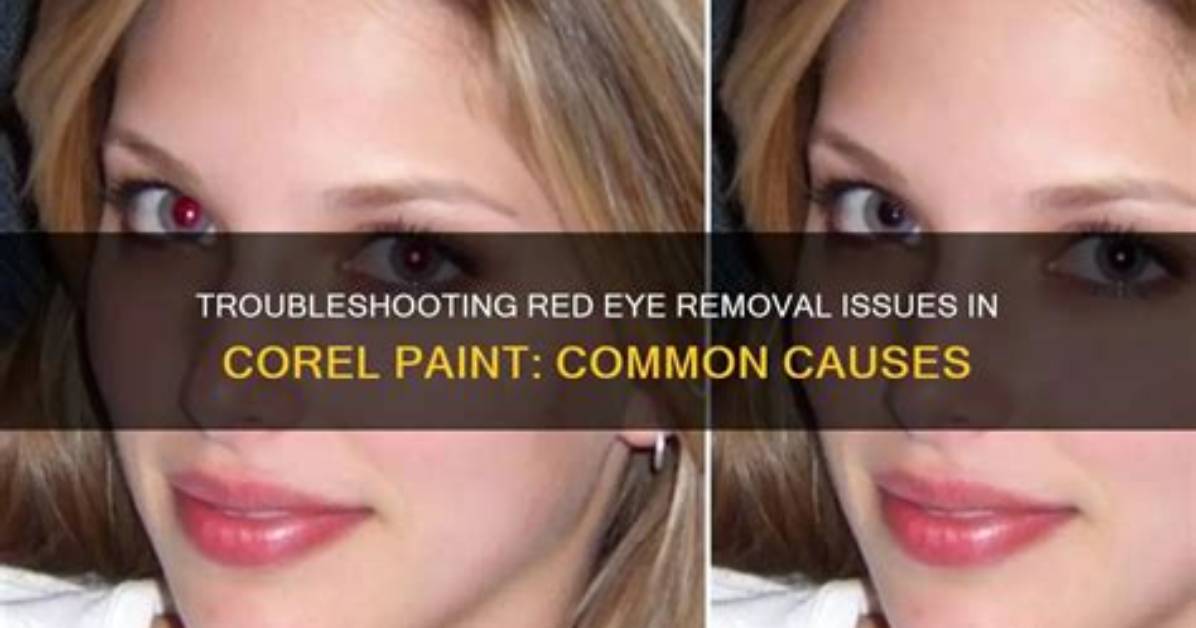 Exploring Caro's Red Eye on Love Island