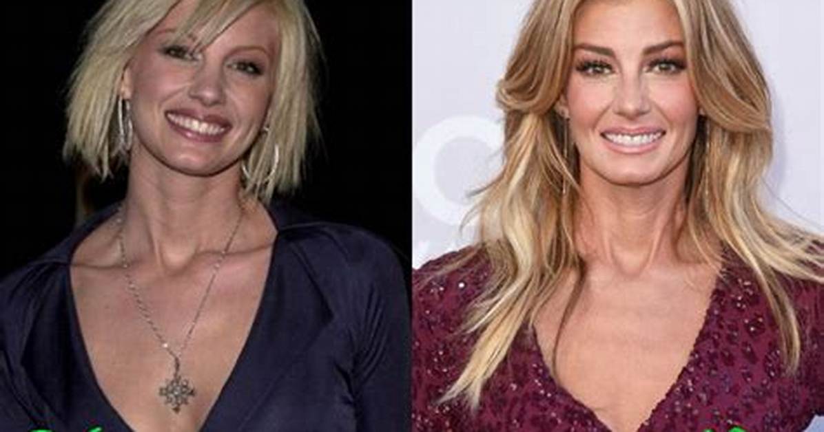 Faith Hill Surgery: an in-Depth Look at the Surgery She Underwent