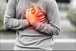 Heart Attack or Hidden Circumstances?