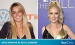Heidi Montag's Incredible Plastic Surgery Transformation: Before and After