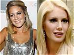 Heidi Montag's Stunning Transformation: Before and After Surgery