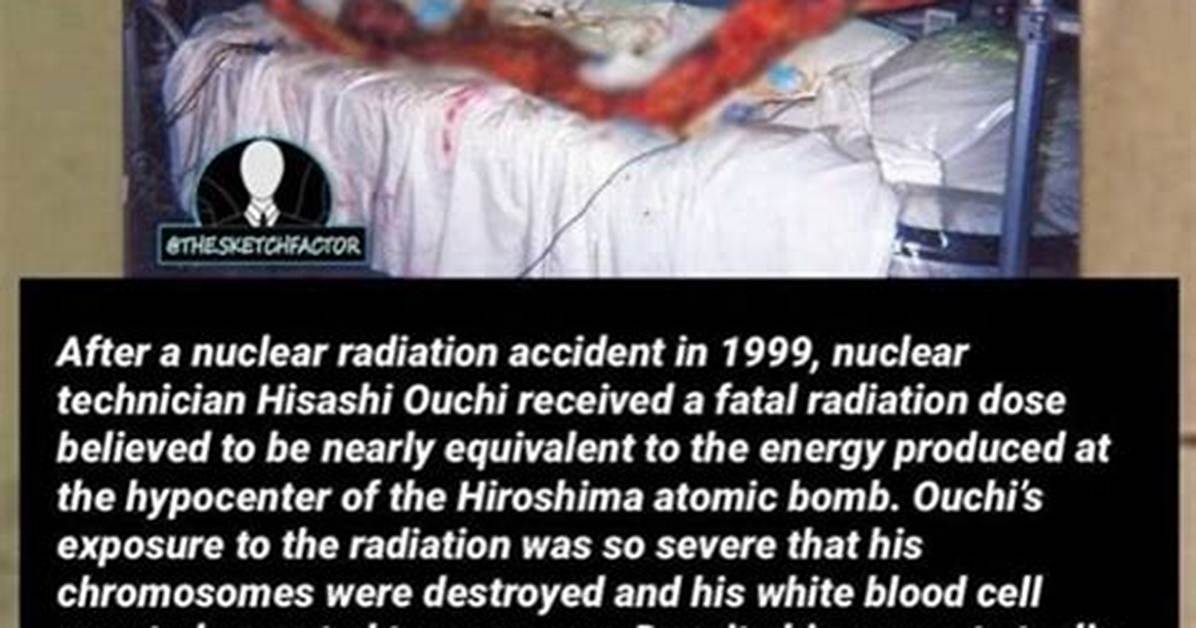Hisashi Ouchi's Uncensored Photos: a Deeper Truth Revealed