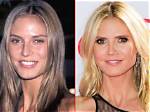 Incredible "Before and After" Transformation of Heidi: a Journey of Beauty and Inspiration