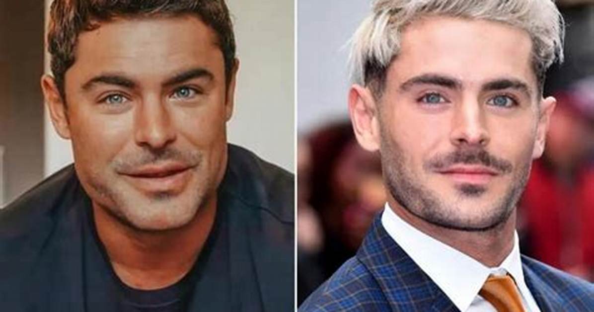 Insights into Zac Efron's Plastic Surgery Journey