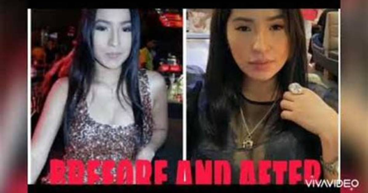 Jelai Andres Before and After Plastic Surgery, Old Photos Age and Wikipedia