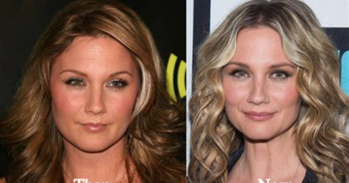 Jennifer Nettles Plastic Surgery-Before After Pics, Weight Loss and Age