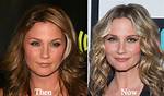 Jennifer Nettles Plastic Surgery-Before After Pics, Weight Loss and Age