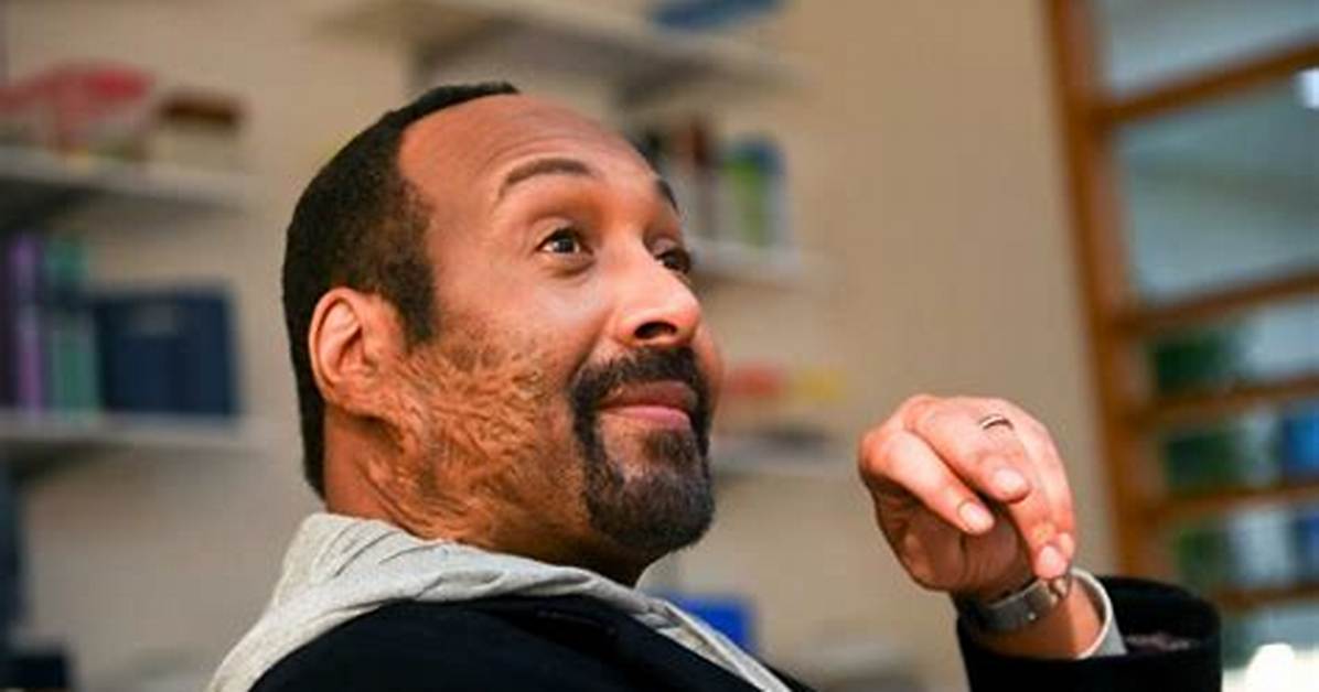 Jesse L. Martin: a Scarred Actor's Journey