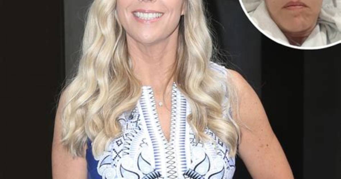 Kate Gosselin's Shocking Injury: Details and Aftermath