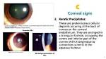 Keratic Precipitates: a Comprehensive Guide to Diagnosis and Management
