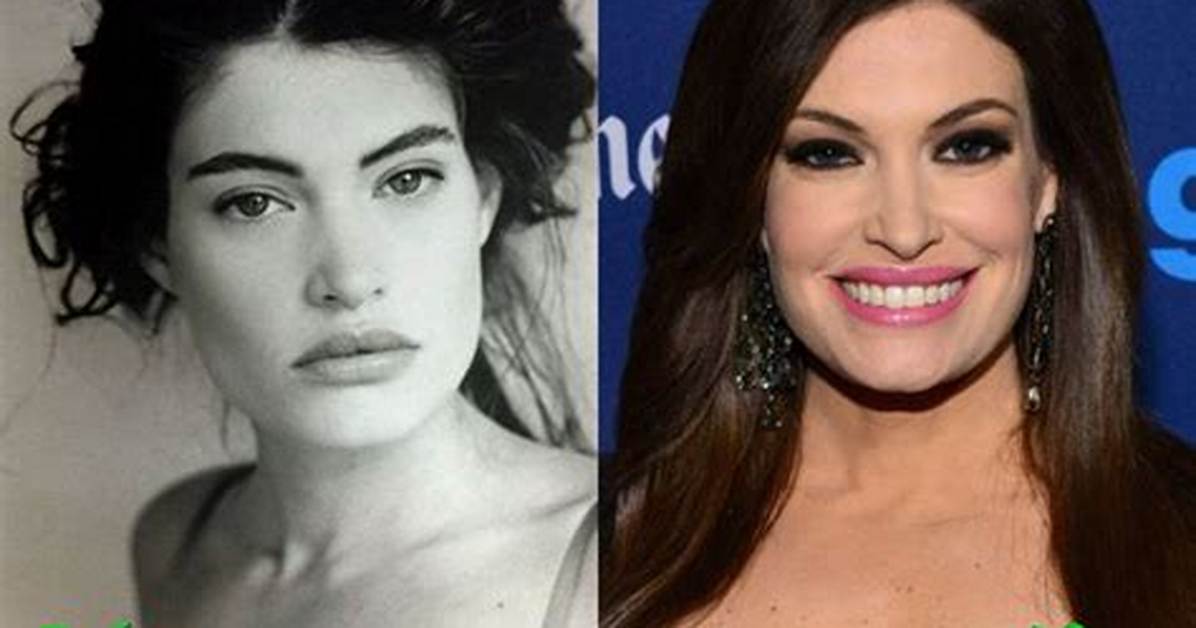 Kimberly Guilfoyle: Before and After Plastic Surgery Transformation