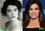Kimberly Guilfoyle: Before and After Plastic Surgery Transformation