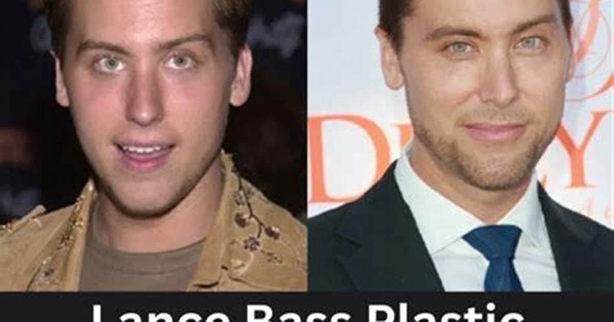 Lance Bass Plastic Surgery: All the Details, Before and After