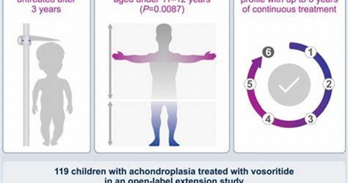 Life Expectancy of Individuals with Achondroplasia: an Informative Guide