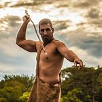 Matt Wright Naked and Afraid Leg Injury: What You Need to Know About Necrotizing Fasciitis