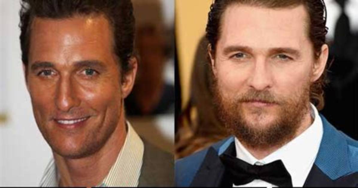 Matthew Mcconaughey's Guide to Plastic Surgery: Unlocking Youthful Beauty