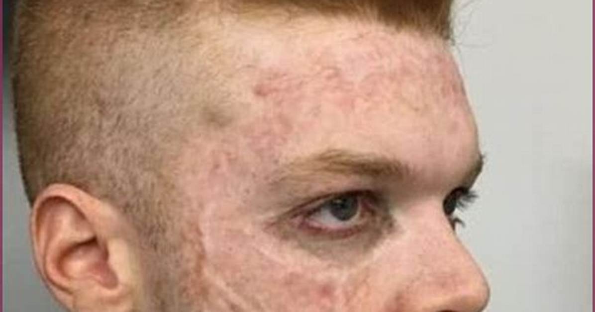 Meet the Masterful Actor Behind Jerome Valeska: Uncover Their Identity