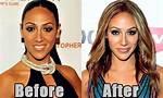 Melissa Gorga Net Worth, House, Plastic Surgery, Nose Job.