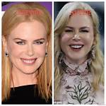 Nicole Kidman's Plastic Surgery Journey: Unveiling the Truth