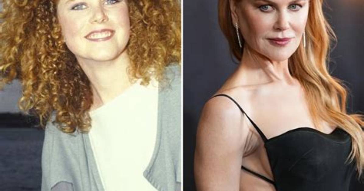 Nicole Kidman's Transformation: Before and After Plastic Surgery