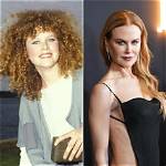Nicole Kidman's Transformation: Before and After Plastic Surgery