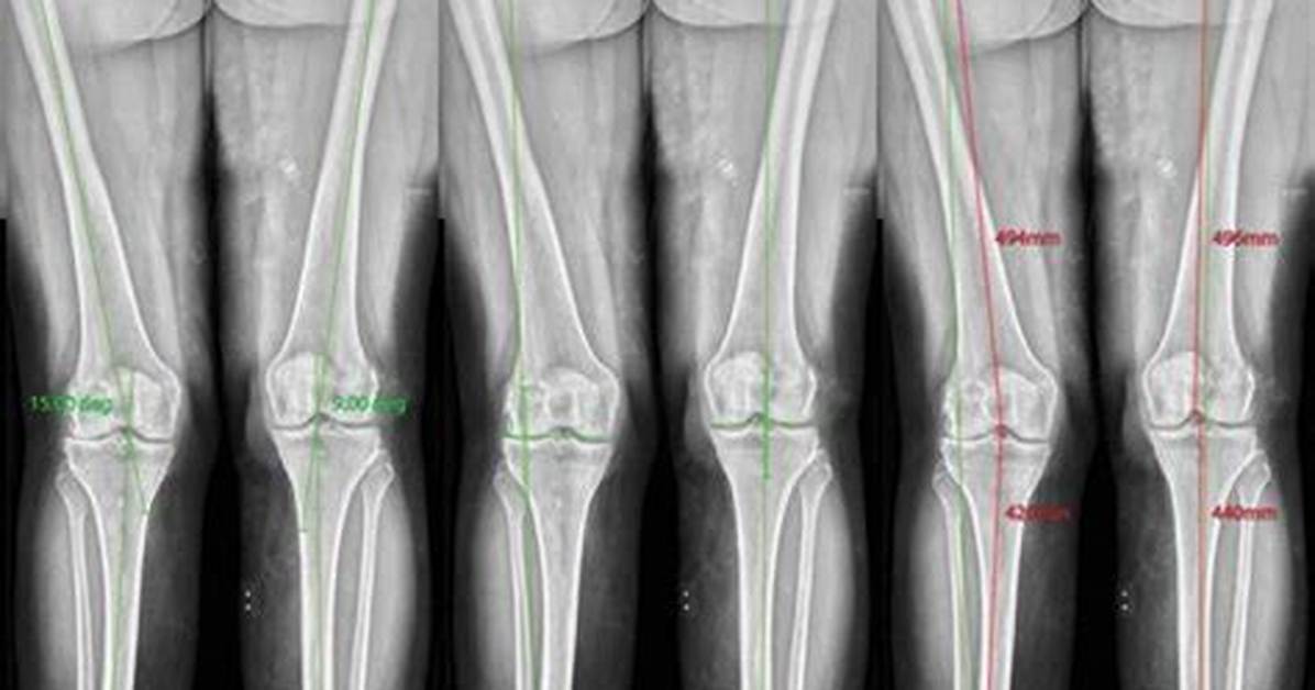 Optimal Leg to Height Ratio: the Ultimate Guide to Body Proportions
