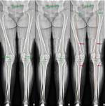 Optimal Leg to Height Ratio: the Ultimate Guide to Body Proportions