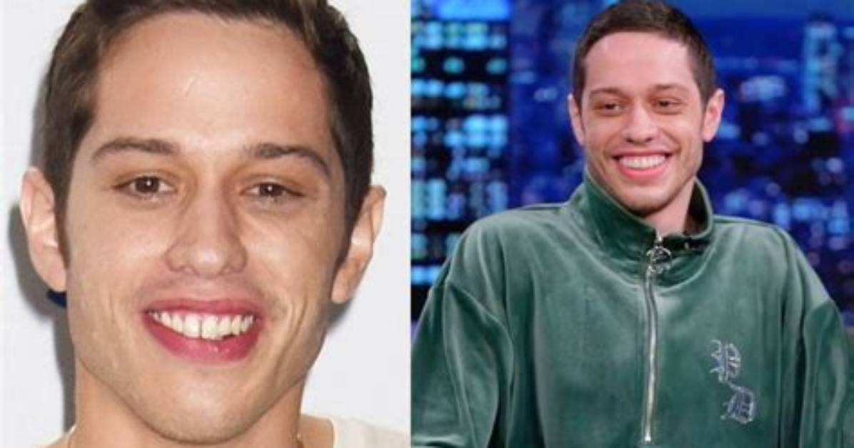 Pete Davidson: Plastic Surgery Unveiled?