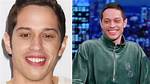 Pete Davidson: Plastic Surgery Unveiled?