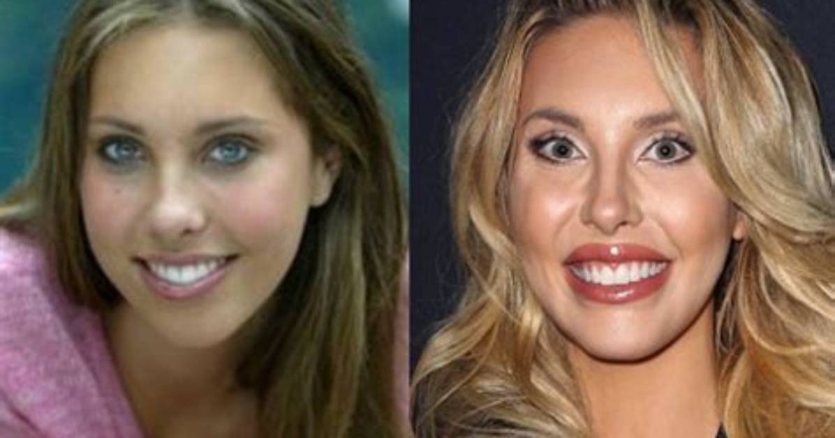 [Pics] Chloe Lattanzi’s Plastic Surgery Before & After Pics: – Hollywood Life