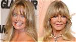 Plastic Surgery Speculations: Examining Goldie Hawn's Transformation