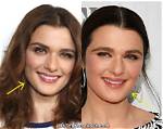 Rachel Weisz Plastic Surgery: Unveiling Secrets and Truths