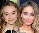 Sabrina Carpenter Before and After Nose Job: a Transformation Explored