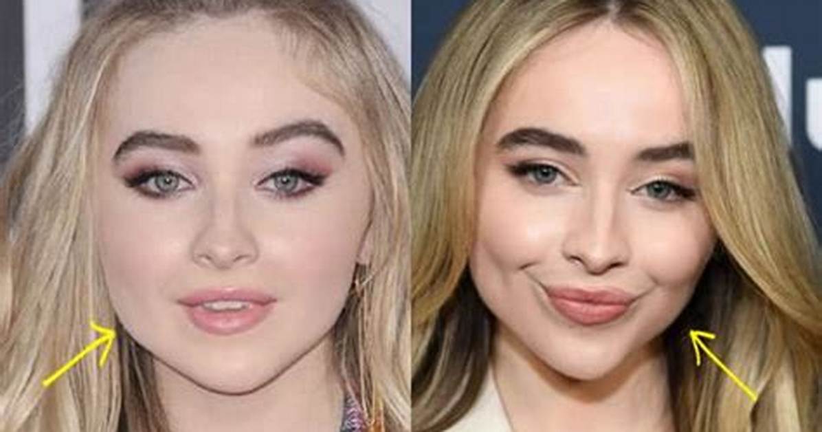 Sabrina Carpenter's Lip Injections: the Truth Revealed